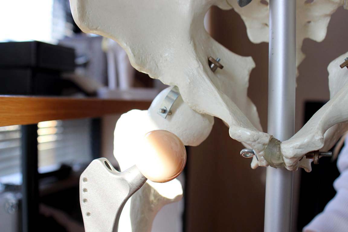 Hüftprothese Knochen