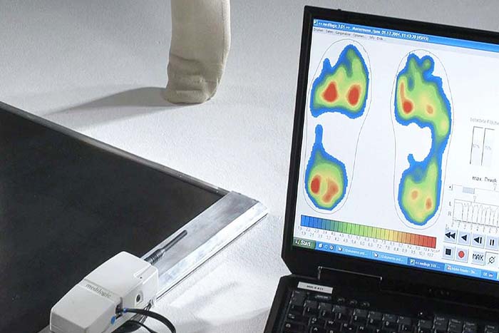 Sensomotorische Fussdruckmessung
