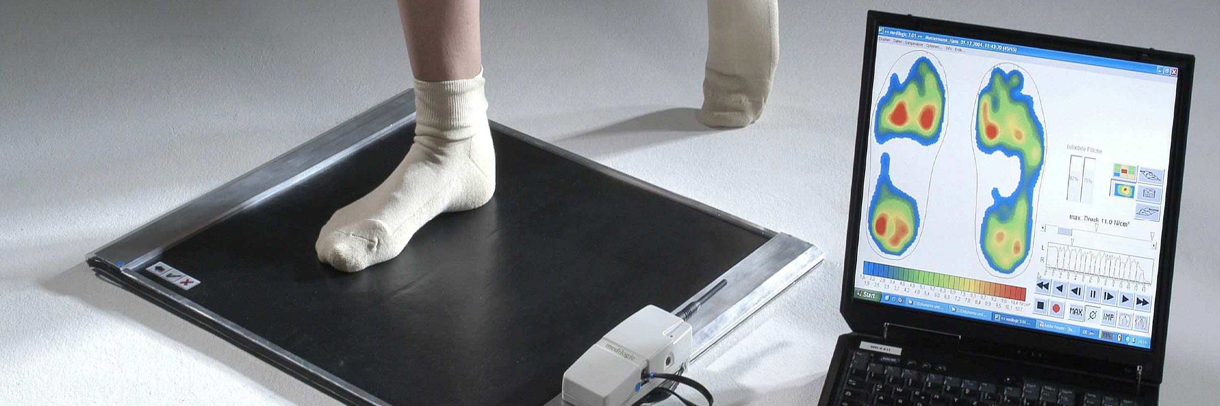 Sensomotorische-Fussdruckmessung